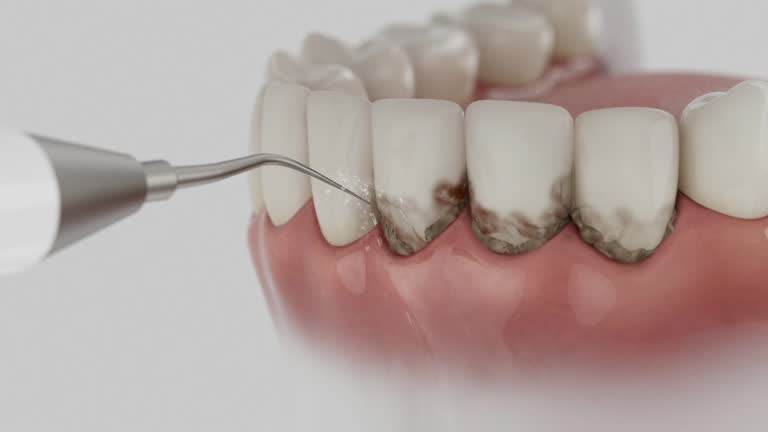 Reliable Tooth Extraction contractor in Waldo County County, ME by Dentist Open Now